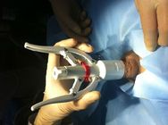 Apilado de circuncisão descartável durável, dispositivo de circuncisão para adultos multiuso.